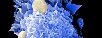 national-cancer-institute-gyGyIEeikSw-400x150-1 electron microcope cancer image