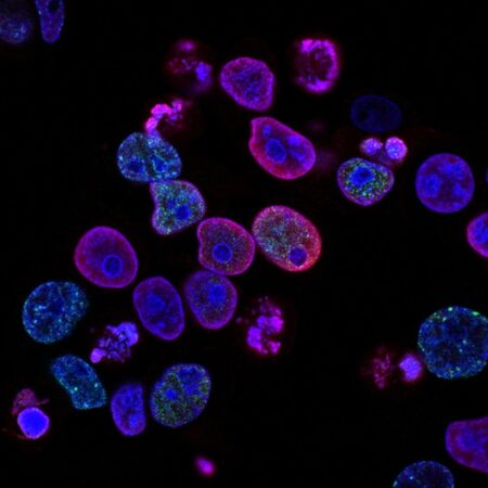 national-cancer-institute-L7en7Lb-Ovc-unsplash Photo of Human colorectal cancer cells